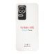 Чехол TPU Virgin Full Camera для Xiaomi Poco F4 Transparent 2020000324010 фото 2